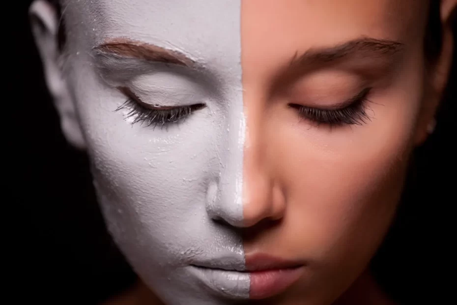How To Cover Vitiligo With Makeup