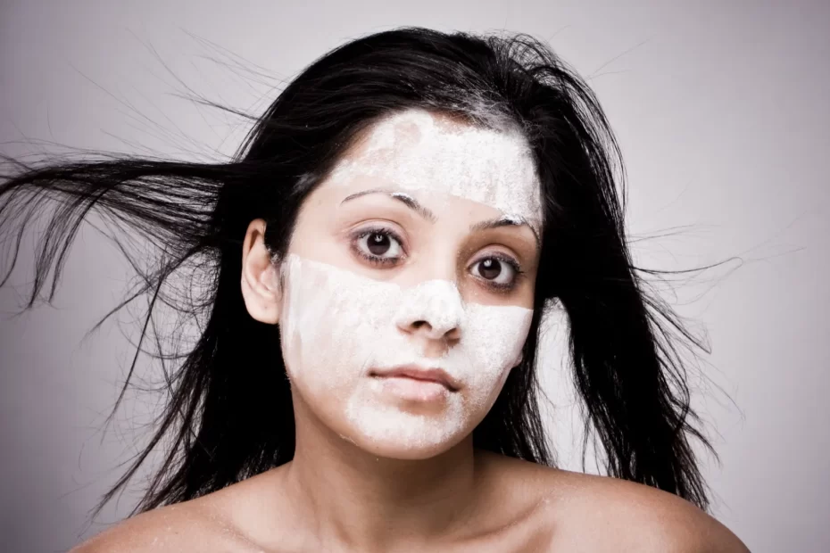Vitiligo İndian Girl